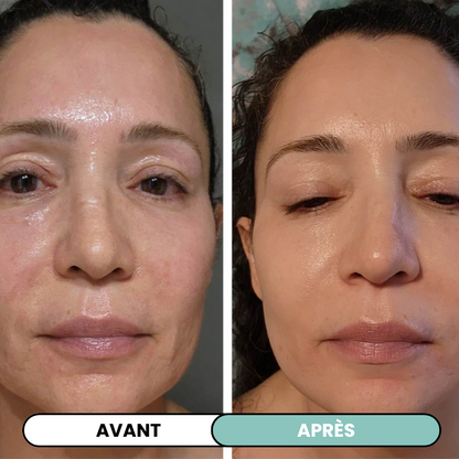 Kit Micro infusion anti-âge