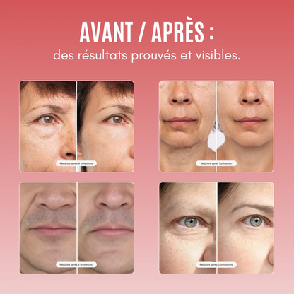 Masque Collagène